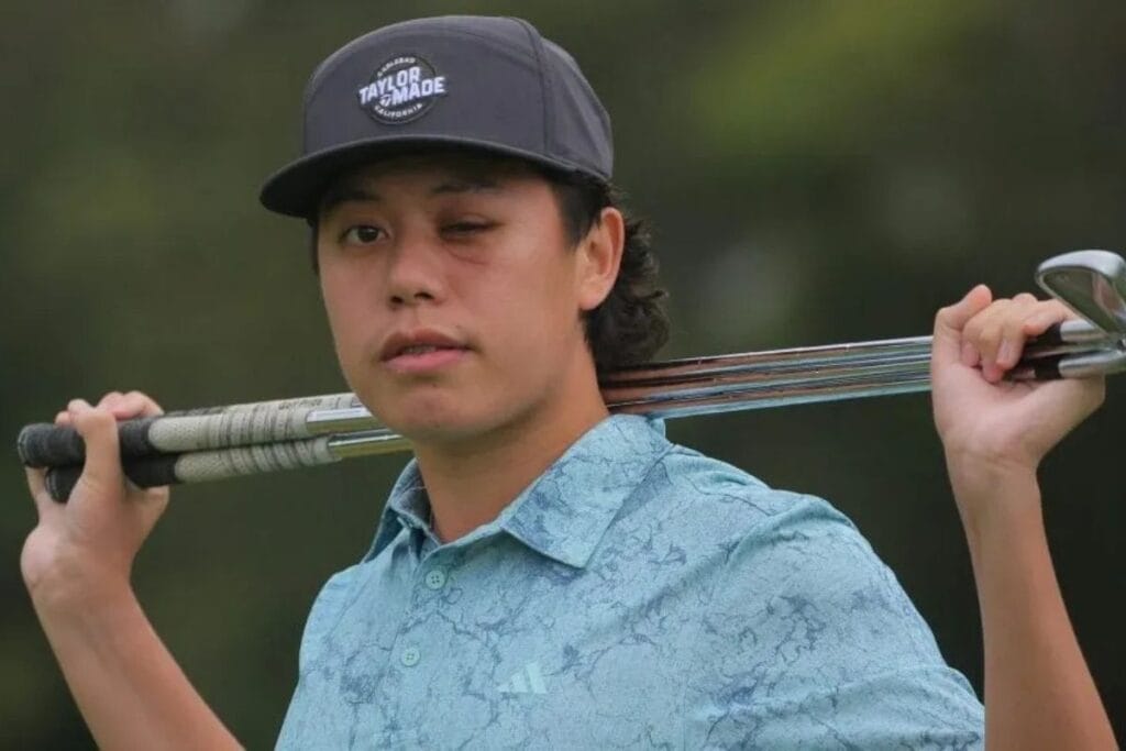 Jeff Guan gibt ein Gesundheits-Update, nachdem ihn ein Golfball am Auge verletzt hatte (Foto: Instagram)